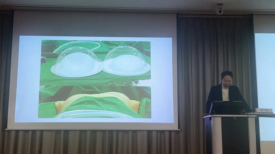 Breast Rippling: If Symptoms Appear, Do You Need Revision Surgery? (Advice from 20 Years of Research)